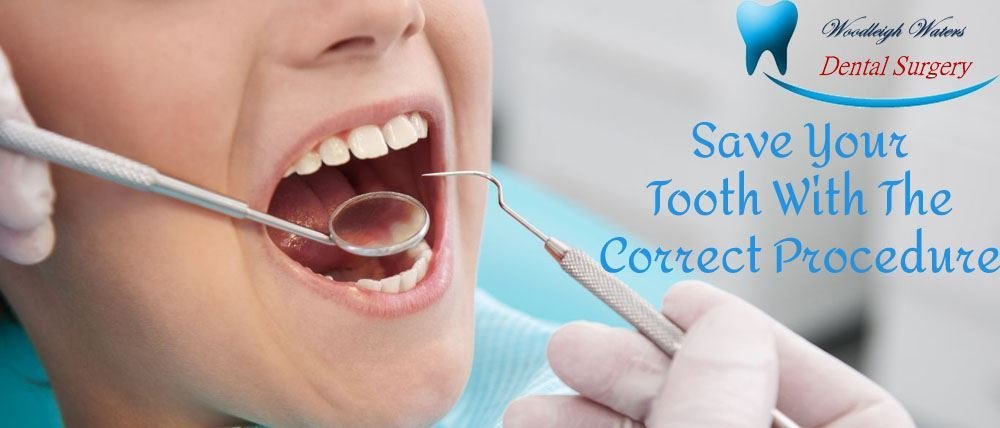 Save That Tooth How To Save Your Tooth With The Correct Procedure – Woodleigh Waters Dental